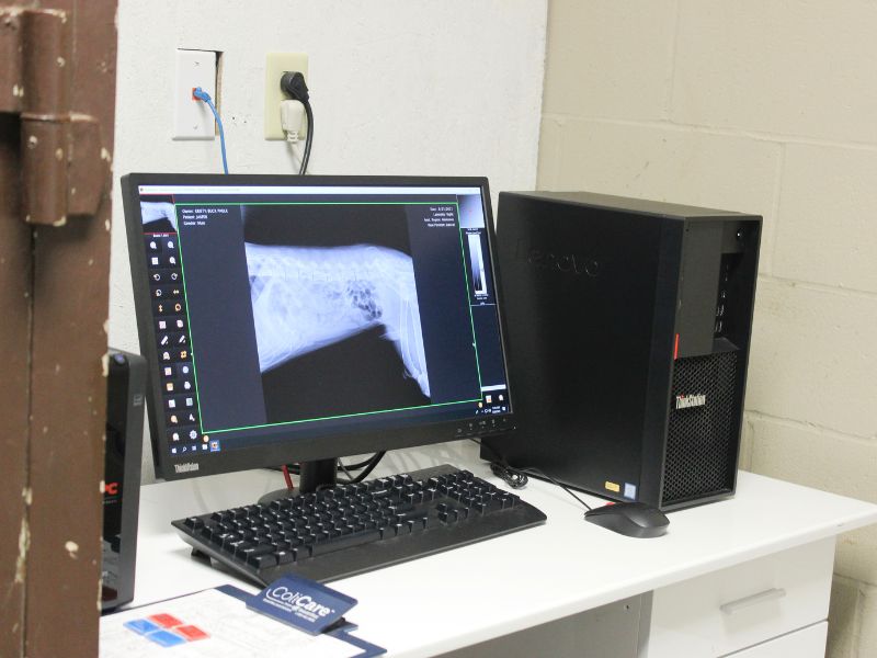 An x-ray showing in the monitor screen